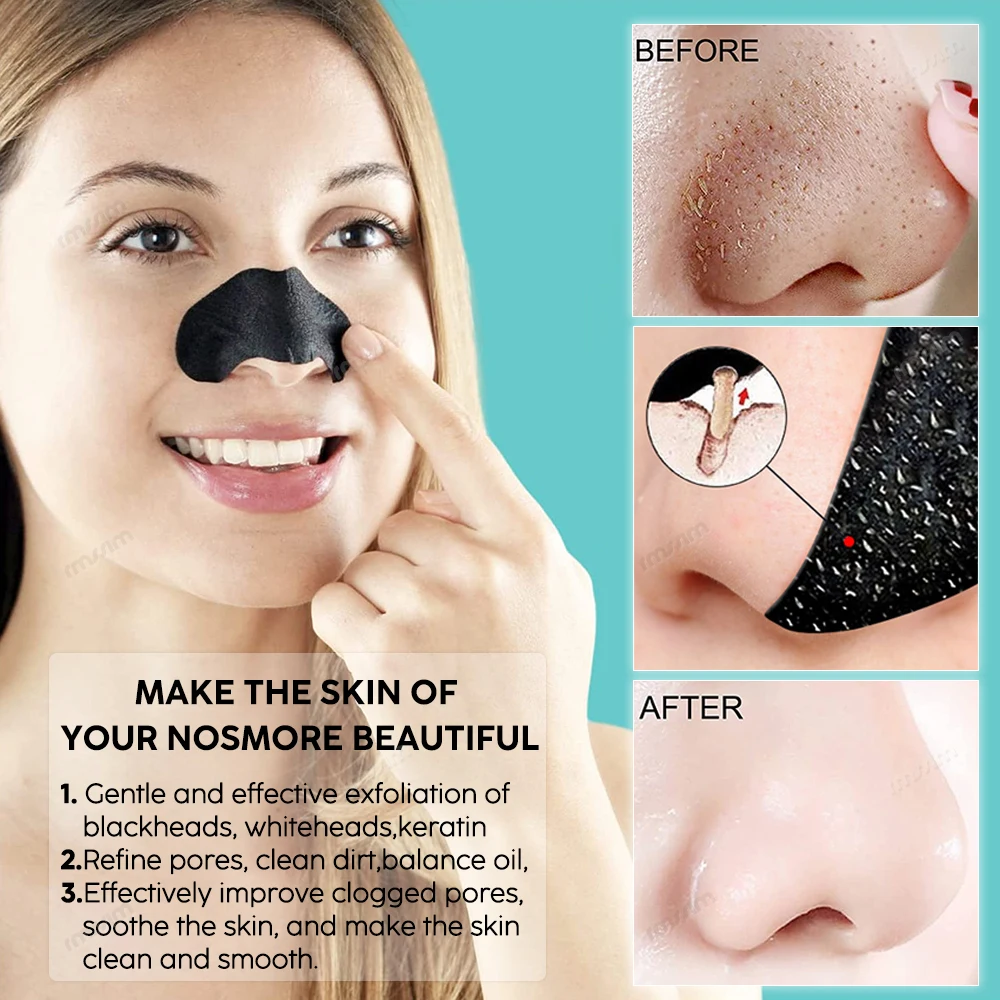 Acb52fde8e57d441799b92703baea9b7f1 10-100PC Blackhead Remover Mask Nasal Strips Black Head Nose Dot Spot Peel Off Sticker Face Acne Whitehead Pore Cleaner Nose
