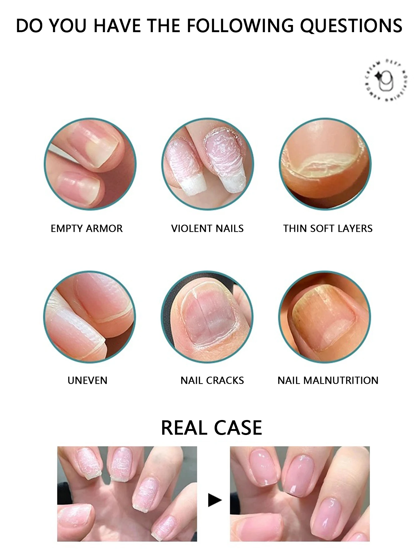 Peelable Vitamin Base Base Gel for Gel Nail Polish, Protect, Strengthen and Repair Nails, Clear Gel, UV LED, Home and Salon