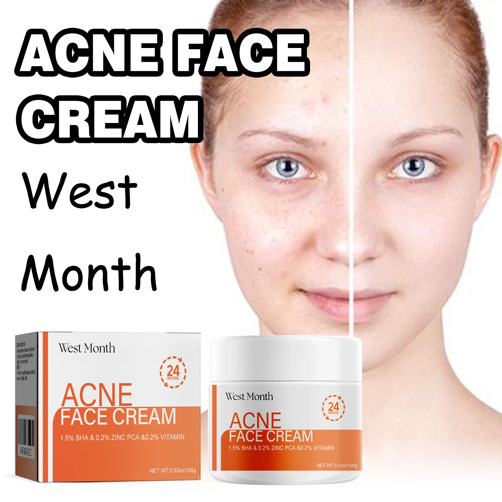 West Month Salicylic Acid Face Cream Moisturizing Acne Treatment Improve Roughness Pore Shink Remove Acne Scars Face Cream