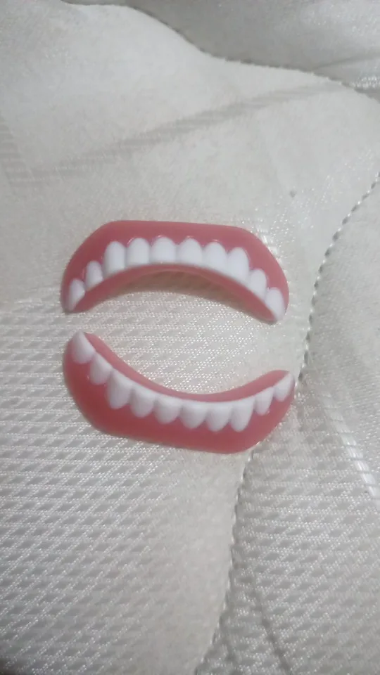 Instant Smile Teeth Veneers photo review