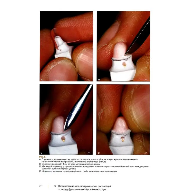 Рисунок 5 - Книга Металлокерамические реставрации