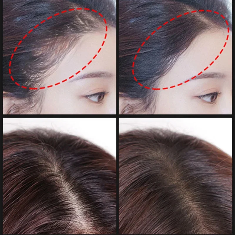 ZS Stem Cell Hair Growth Serum EGF Lyophilized Powder 28 Days Fast Grow Hair Regrowth Kit Growth Factor Loss Treatment for hair growth serum
