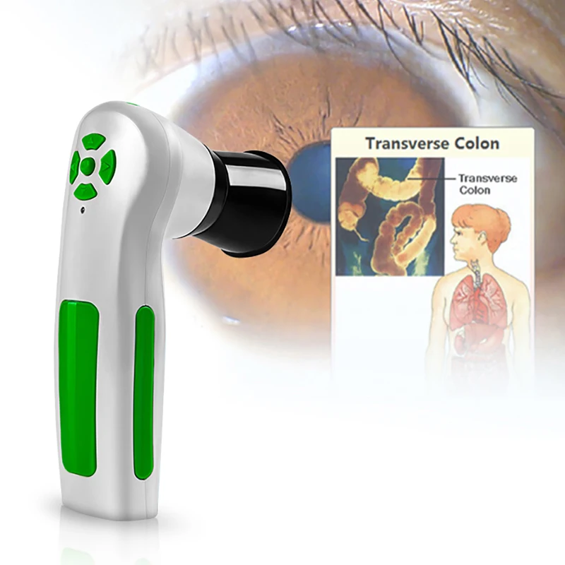 Diagnostic Eye Camera 12MP HD 30x Iris Lens and Driver-Free Analysis Software High Resolution CCD USB Iriscope 1 2 5 hd 5mp 6mm fixed iris m12 mtv ir board cctv lens view 70 degrees for security ip camera