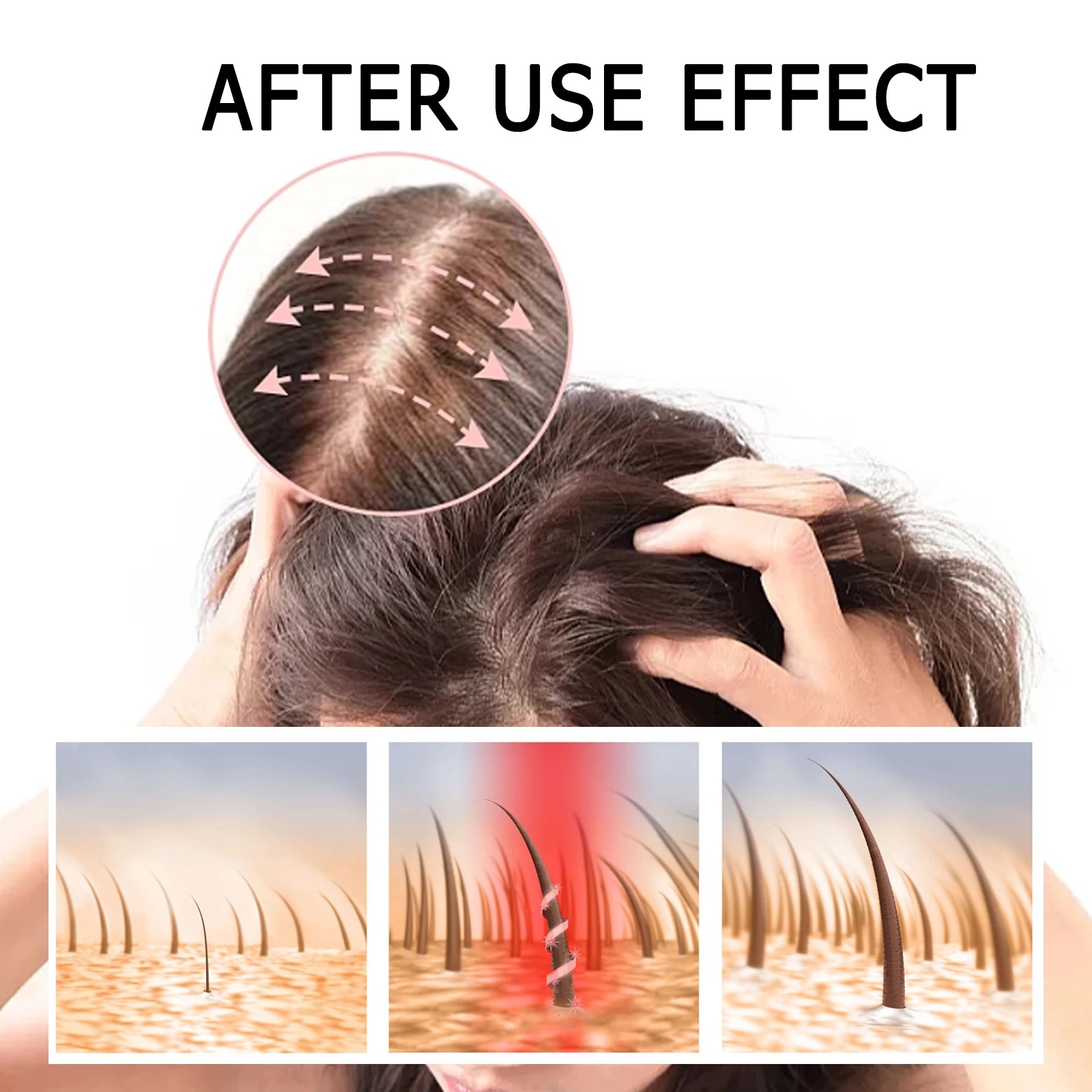 Eelhoe Germinal Capsule Ginge Dense Hair Capsule Moisturizes Hair Roots Thickens Prevents Loss, Scalp Massage