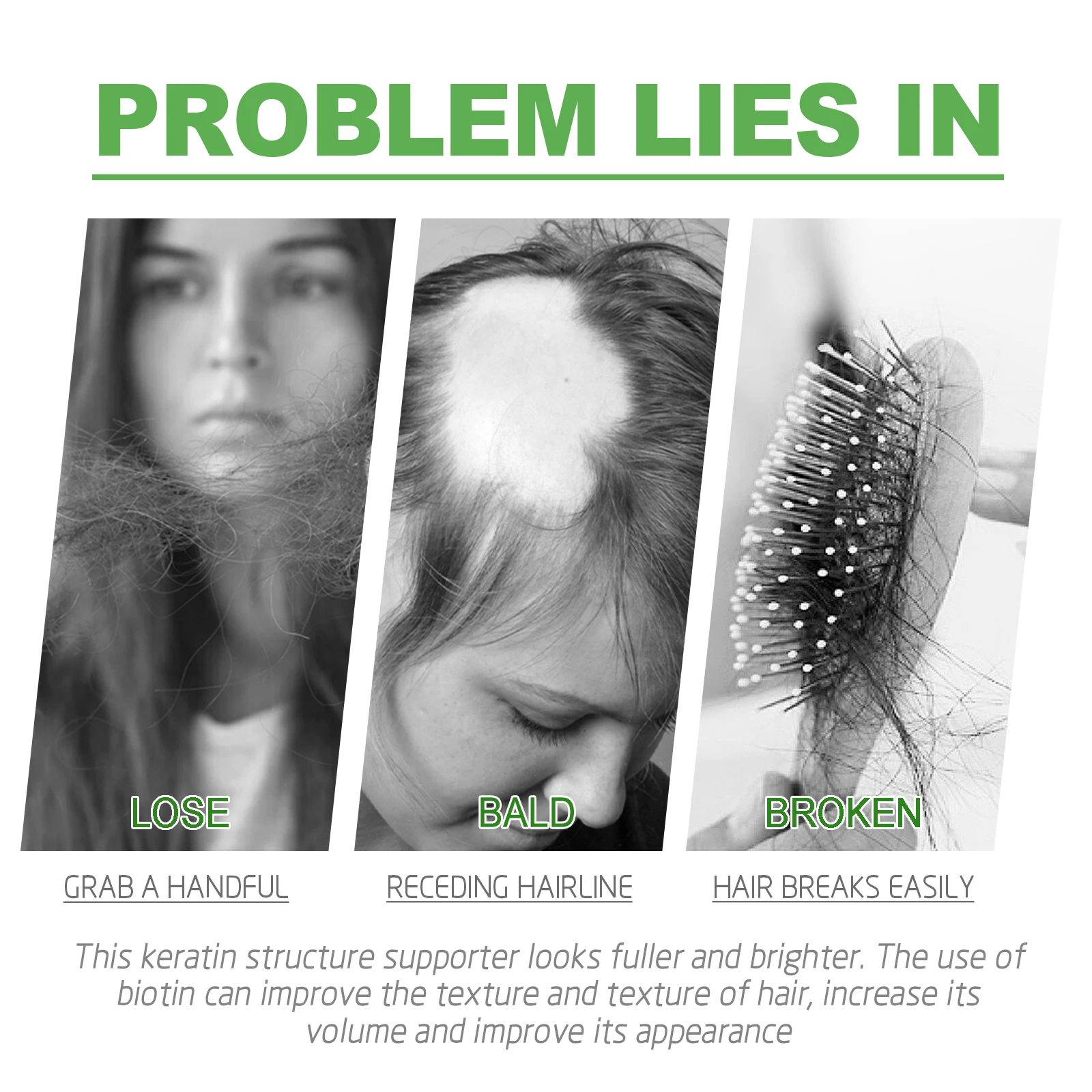 Eelhoe Germinal Capsule Ginge Dense Hair Capsule Moisturizes Hair Roots Thickens Prevents Loss, Scalp Massage