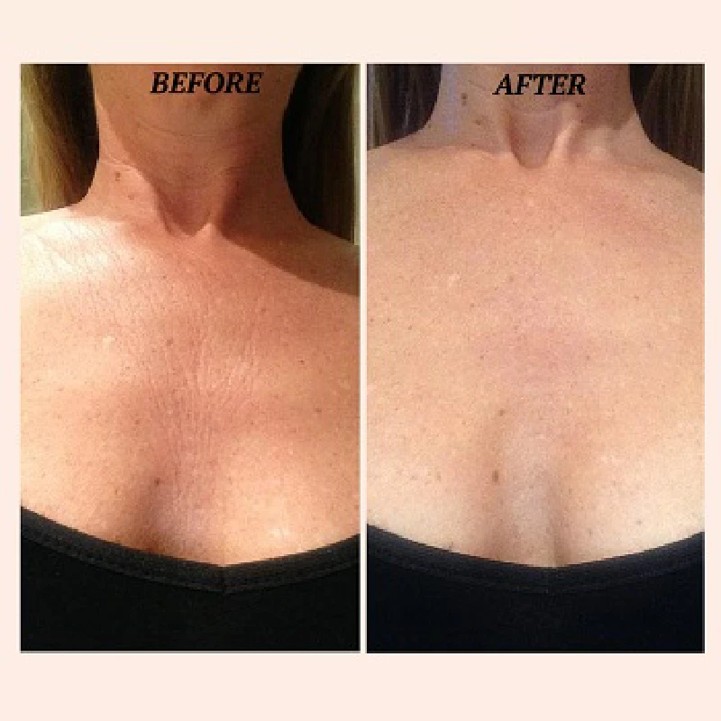 Anti-Wrinkle Between Breast Bra High Quality