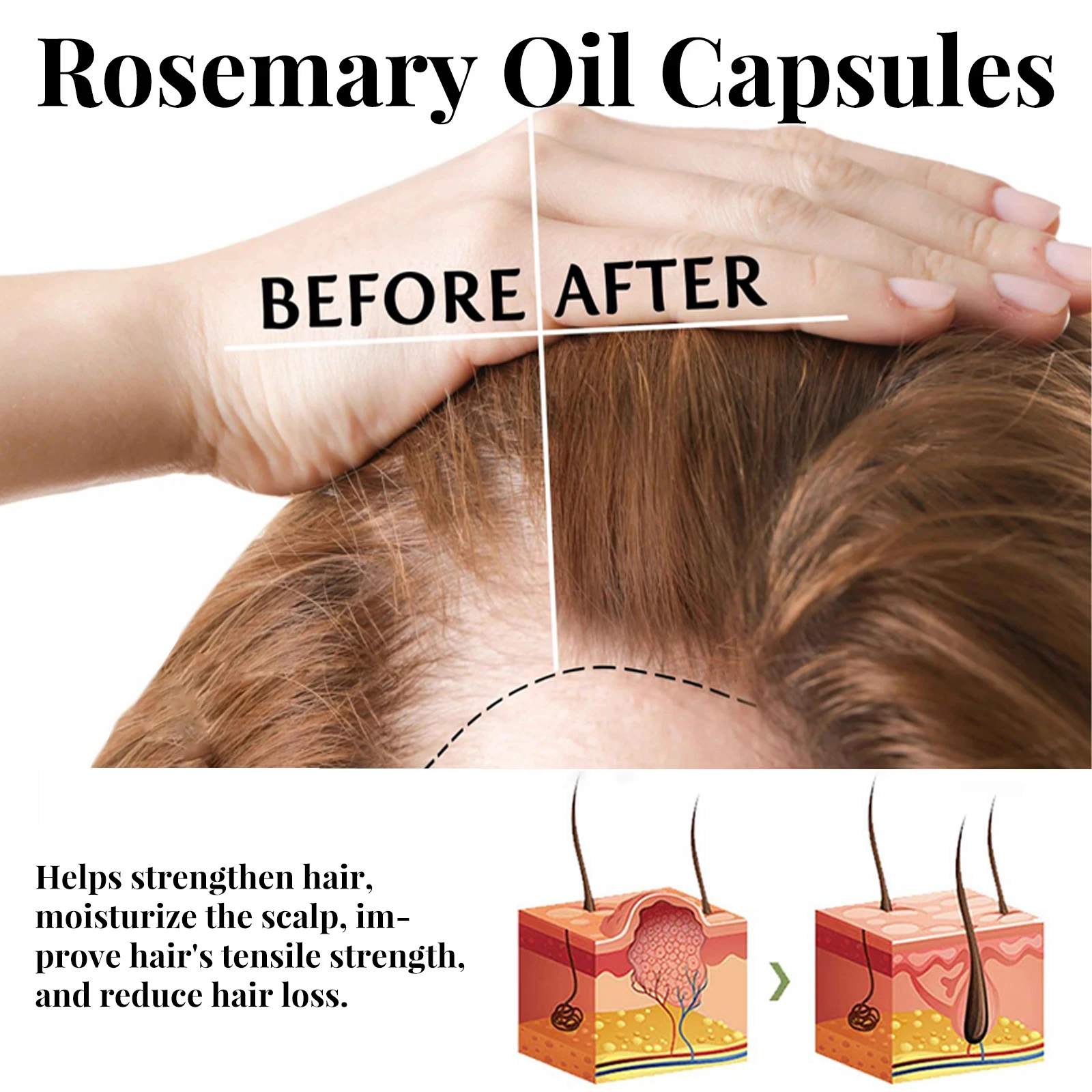 Eelhoe Rosemary Hair Care Capsule Hair Care Nourishes Roots Prevents Loss And Moisturizes Essential Oil