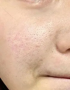 Serum Hidratación Profunda Ácido Hialurónico
