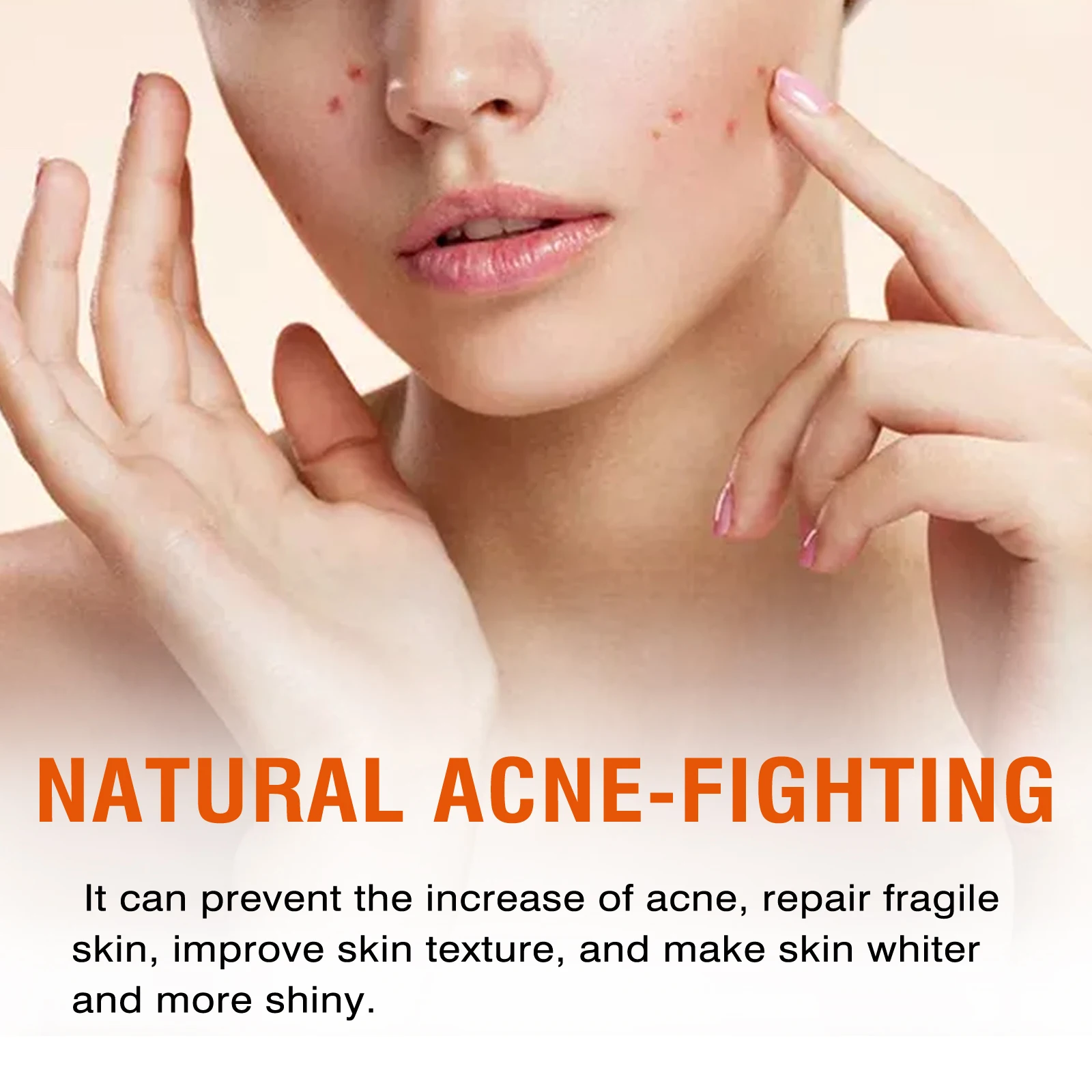 West Month Salicylic Acid Face Cream Moisturizing Acne Treatment Improve Roughness Pore Shink Remove Acne Scars Face Cream