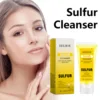 Facial Cleanser with Sulfur for Removing Clogged Pores A-Cne Treatment Nourish Facial Contours Gentle Exfoliating Facial Scrub 3