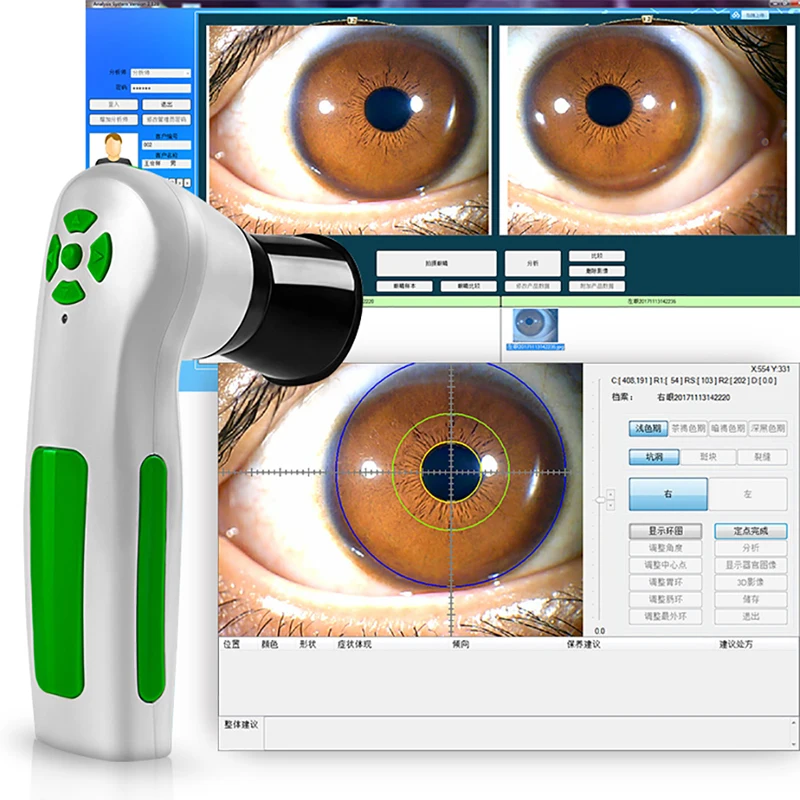 Diagnostic Eye Camera 12MP HD 30x Iris Lens and Driver-Free Analysis Software High Resolution CCD USB Iriscope 4