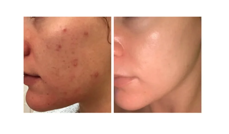 Рисунок 2 - Expigment крем 4% X 3 упаковки