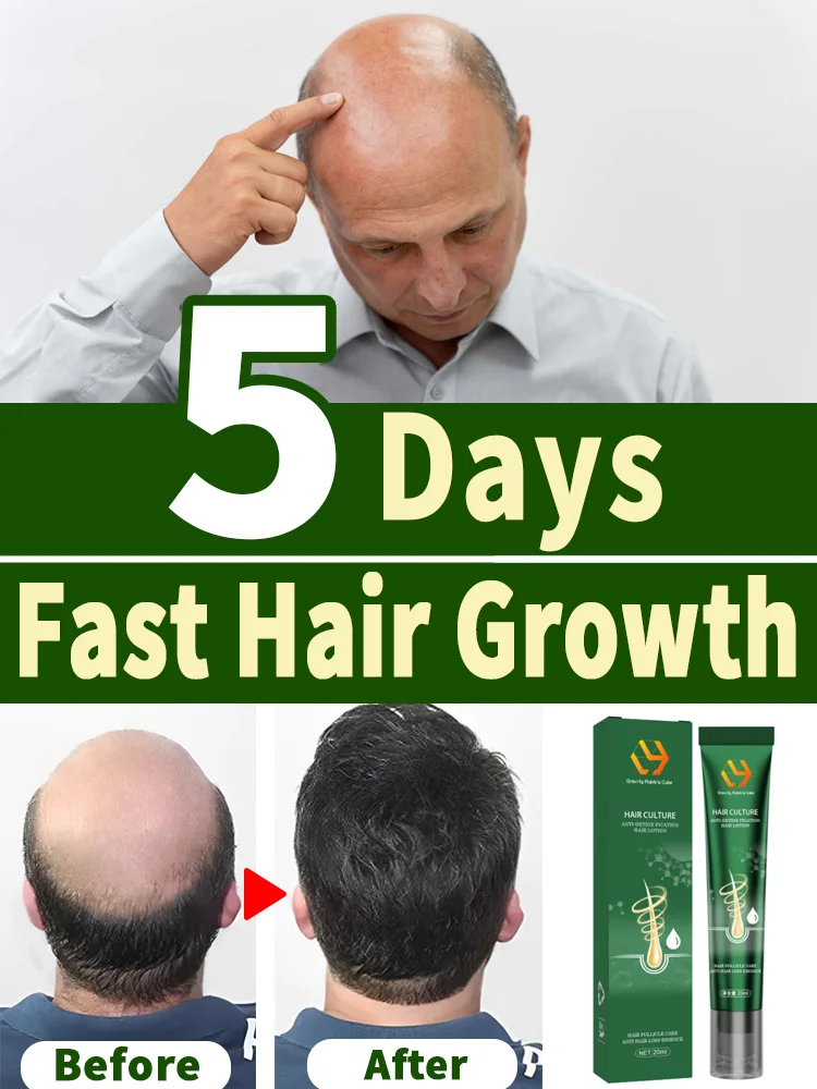 Stunning Fast Hair Growth For Men image