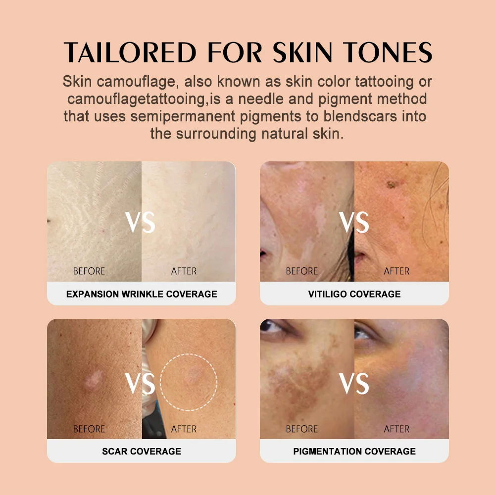 YD Skin Camouflage Pigment 10ml Tattoo Ink Permanent Makeup Color Correct Ink Stretch Mark Skin Pigment Restoration Beauty Art