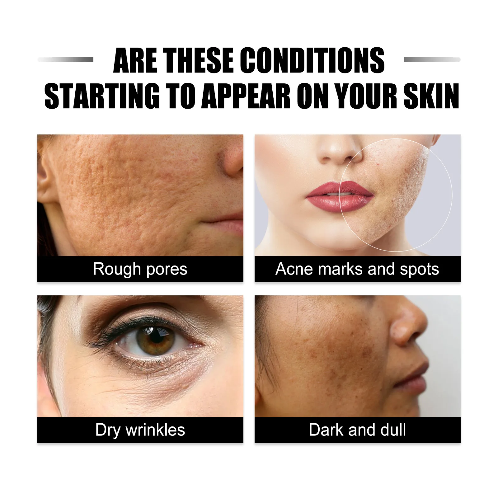 Reduce Dullness Serum Anti Wrinkles Age Brighten Whiten Nourish Repairing Remove Acne Shrink Rough Pores Fade Fine Lines Essence 6