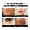 Reduce Dullness Serum Anti Wrinkles Age Brighten Whiten Nourish Repairing Remove Acne Shrink Rough Pores Fade Fine Lines Essence 6