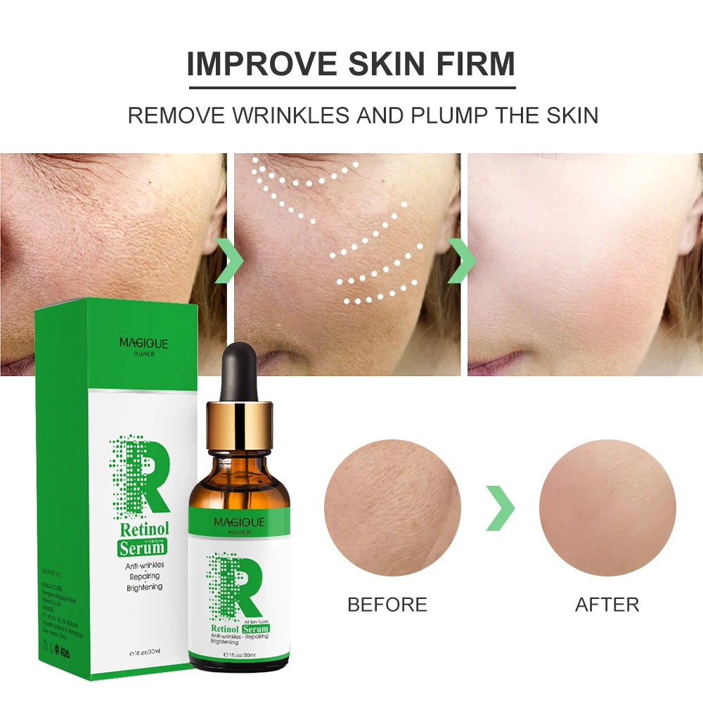 vitamina clareamento rosto soro retinol anti envelhecimento ácido hialurónico hidratante soro facial acne apertar os poros soro da pele