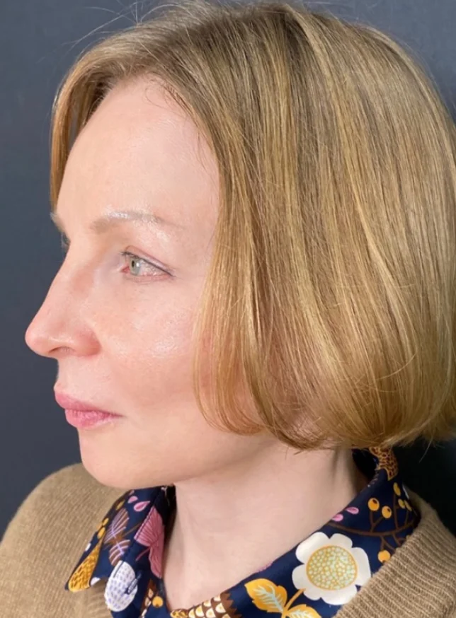 Anti-aging Anti-rynkor Effektiv rynkborttagning Ansiktsserum Ta bort ansiktsrynkor Fina linjer runt ögon och hals Kråkfötter photo review