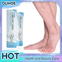 Relieve Vasculitis Cream Phlebitis Worm Spider Legs Vessel Pain Treatment Soothing Reduce Swelling Varicose Vein Relief Ointment 1