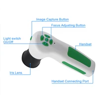 Diagnostic Eye Camera 12MP HD 30x Iris Lens and Driver-Free Analysis Software High Resolution CCD USB Iriscope 2