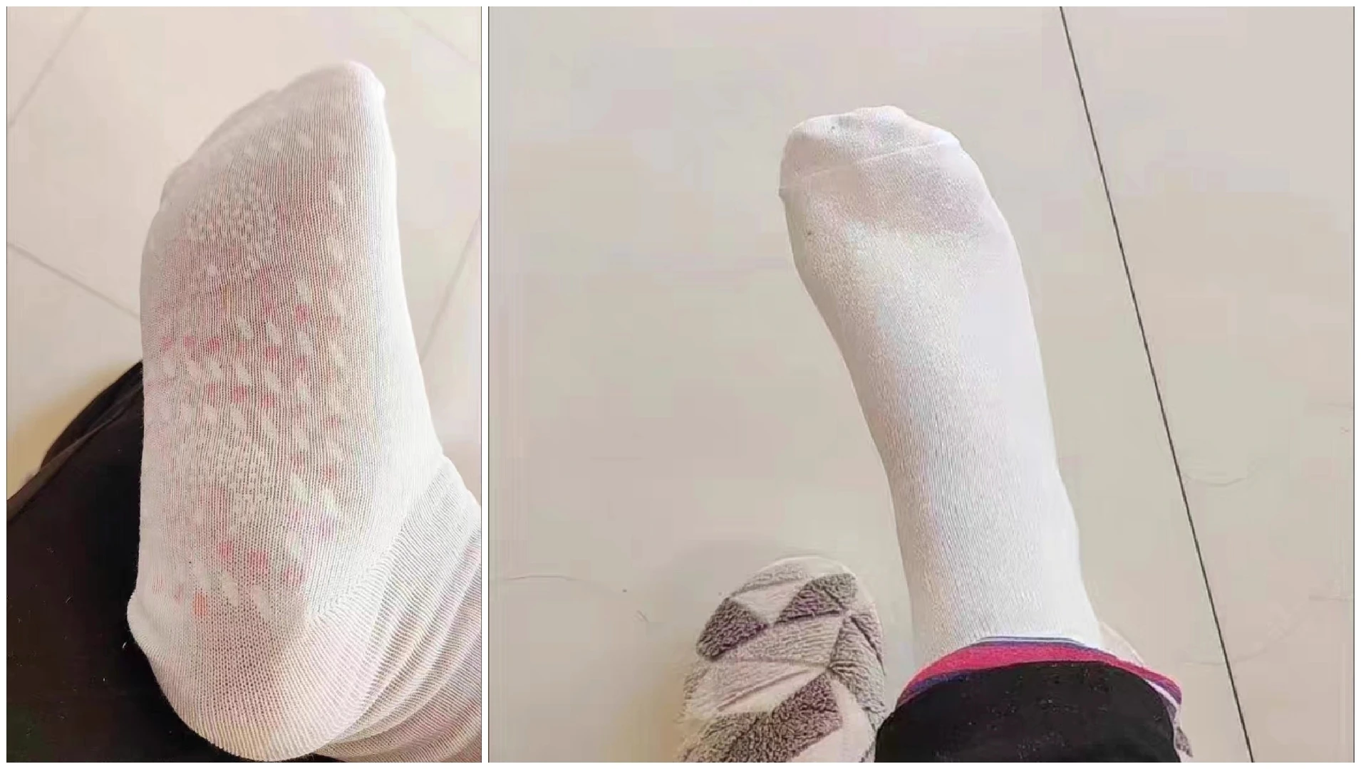 Tourmaline Acupressure Varicose Vein Slim Health Socks Basple