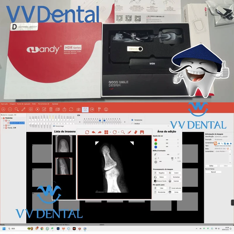 

Odonto sem Galantia рекомендуется рядом с удобным брендовым рентгеновским датчиком USB-соединение компьютерная система визуализации большая HDR-500C/600C 3