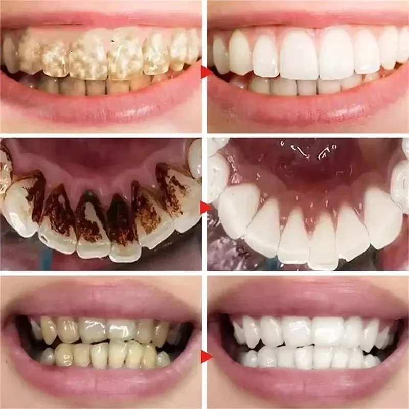 V34 Teeth Whitening Mousse Toothpaste Remove Plaque Stains Cleaning Oral Hygiene Bleaching Dental Tools Fresh Breath Tooth Care teeth whitening product teeth whitening essence teeth health product