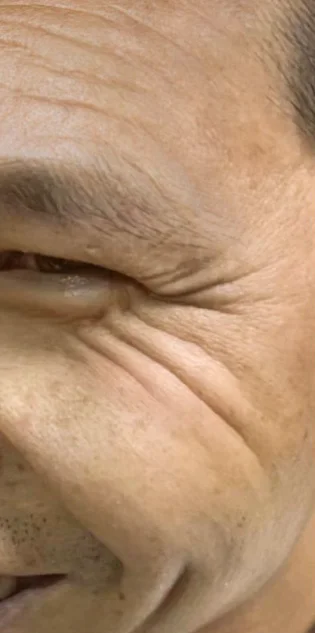 Anti-aging Anti-rynkor Effektiv rynkborttagning Ansiktsserum Ta bort ansiktsrynkor Fina linjer runt ögon och hals Kråkfötter photo review