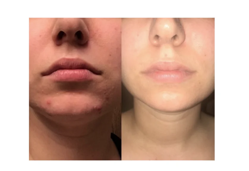 Рисунок 6 - Expigment крем 4% X 3 упаковки
