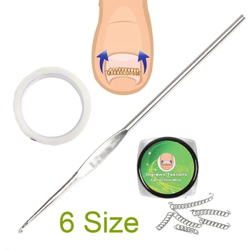 

Ingrown Ended Toe Nail Correction Tool Set Holder Pressure Sensitive Tape Toenail Pedicure Foot Care Tools Set