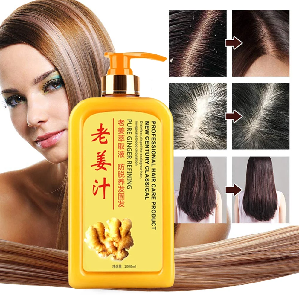 

Chinese Formula Ginger Shampoo for Anti Hair Loss Fast Growth Hair Grow Thicker Dense Control Hair Oil Treatment Dandruff 1000ml