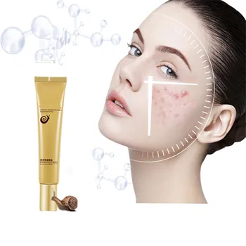 

Moisturizing eye skin eye cream collagen anti wrinkle anti aging lightening black eye bags whitening away Eyeliner iron 20g