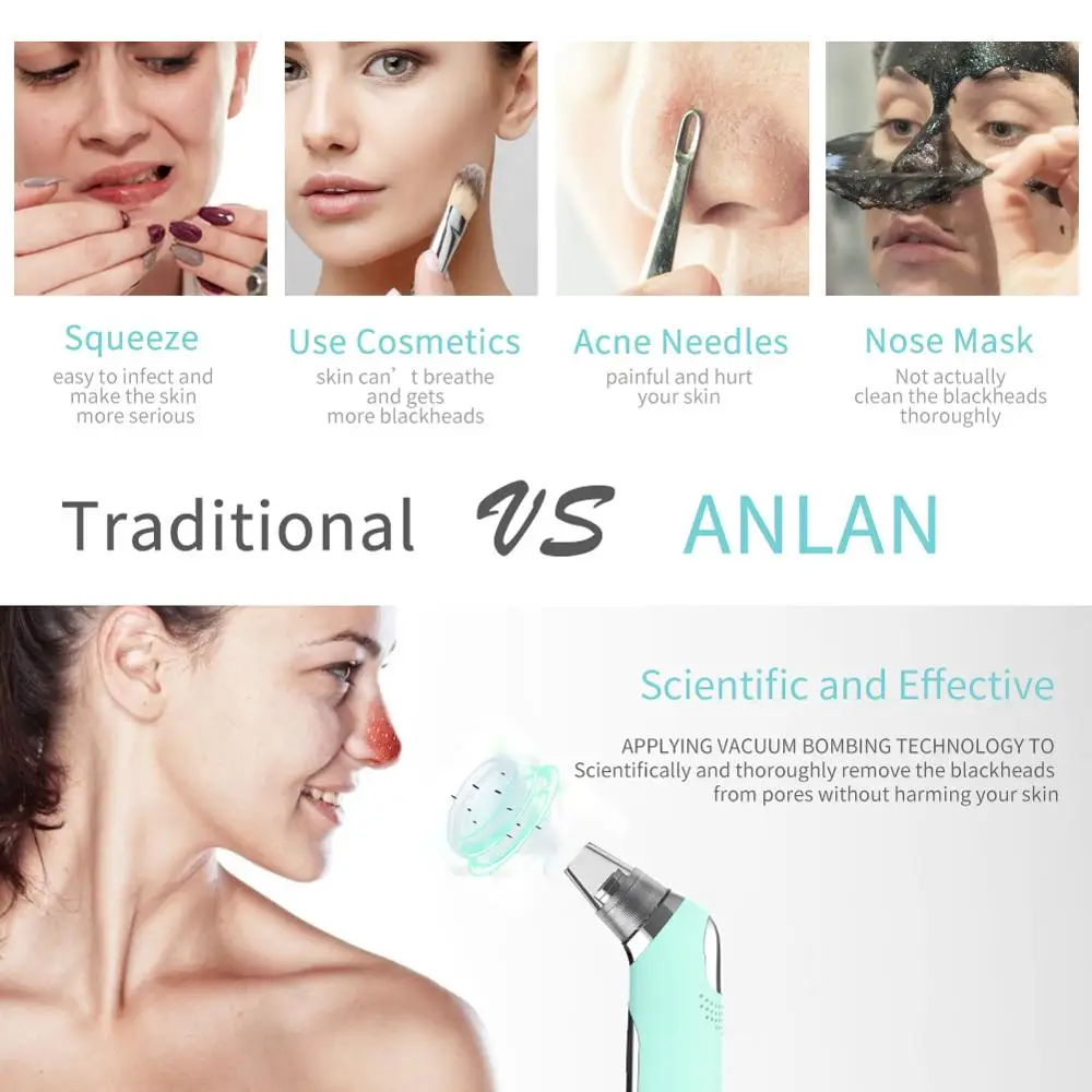 Blackhead Remover Hot Cold Facial Cleaner Deep Pore Acne Pimple Removal Vacuum Suction Diamond Beau