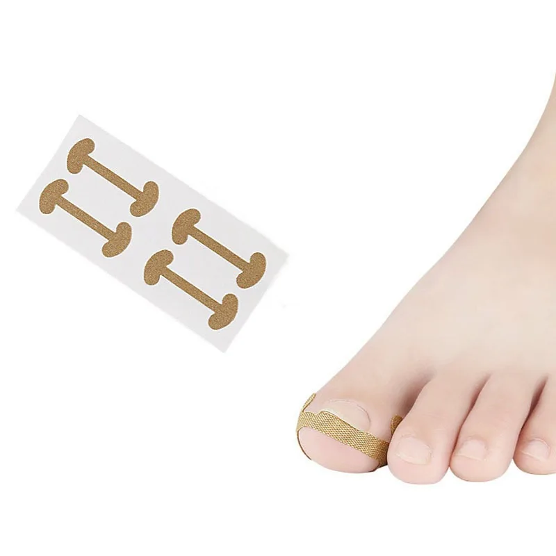 4 шт. корректор для вросших ногтей на ногах лечение паронихии педикюра