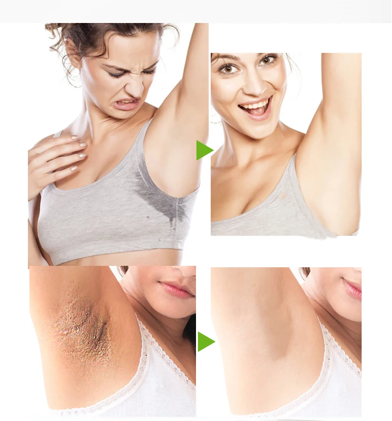 Неприятный запах пота причины. Почему пахнут подмышки даже после мытья. Народные средства от потливости. Почему пахнут подмышки даже после мытья. Избавление от потливости.