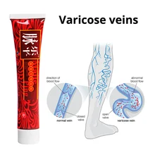 Новое горячее модное лечение Варикозного расширения вен крем варикозность Angiitis крем удаление травяной крем домашняя жизнь ногтей эфирные поставки