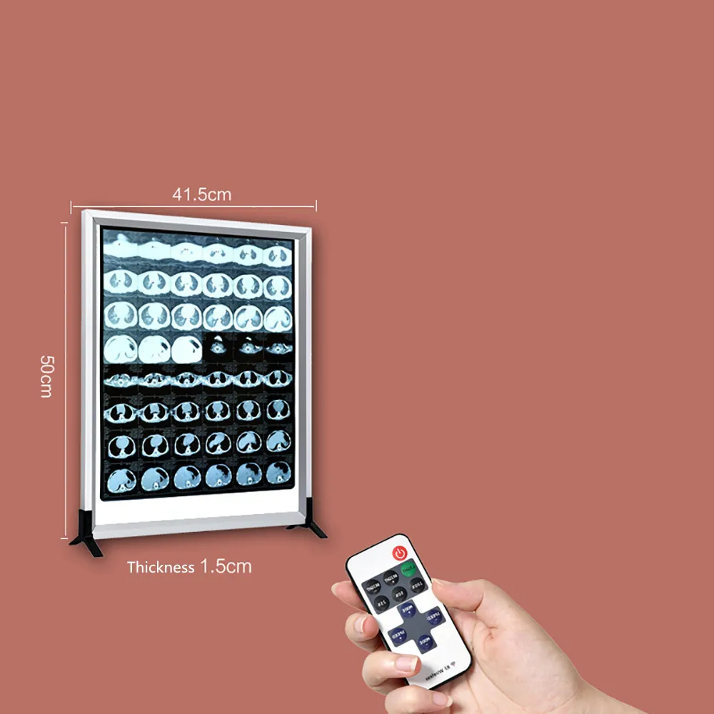 220VRemoteControlXRayFilmIlluminatorDentalOrthopaedicHospital