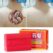 130g medicina sabão mão sabonetes acne banho remoção ácaros sabão inteiro marca shanghai limpar sebo china velho remover odor profundo s u6q7
