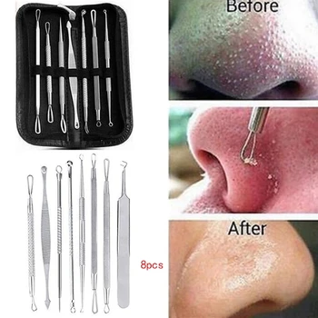 

Stainless Steel Blackhead Whitehead Remover Tool Kit Pimple Spot Acne Extractor Skin Care Face Cleaning Set