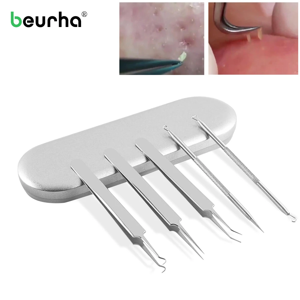 

5Pcs/set Blackhead Removal Extractor Pimple Vacum Comedone Acne Remover Needle Clip Tweezer Set Spots Cleaner Face Care Tools