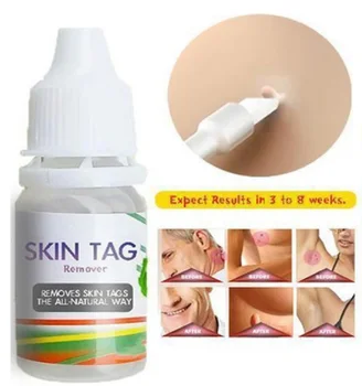 

10ml Body Warts Treatment Cream Skin Tag Genital Wart Remover Foot Corn Removal Plantar Genital Warts Ointment Foot Care Cream