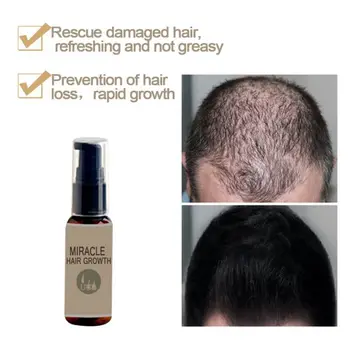 

30ML/50ML Hair Growth Fluid Nourish Hair Roots Thick And Glossy Hair Growth Anti-hair For Men And Women
