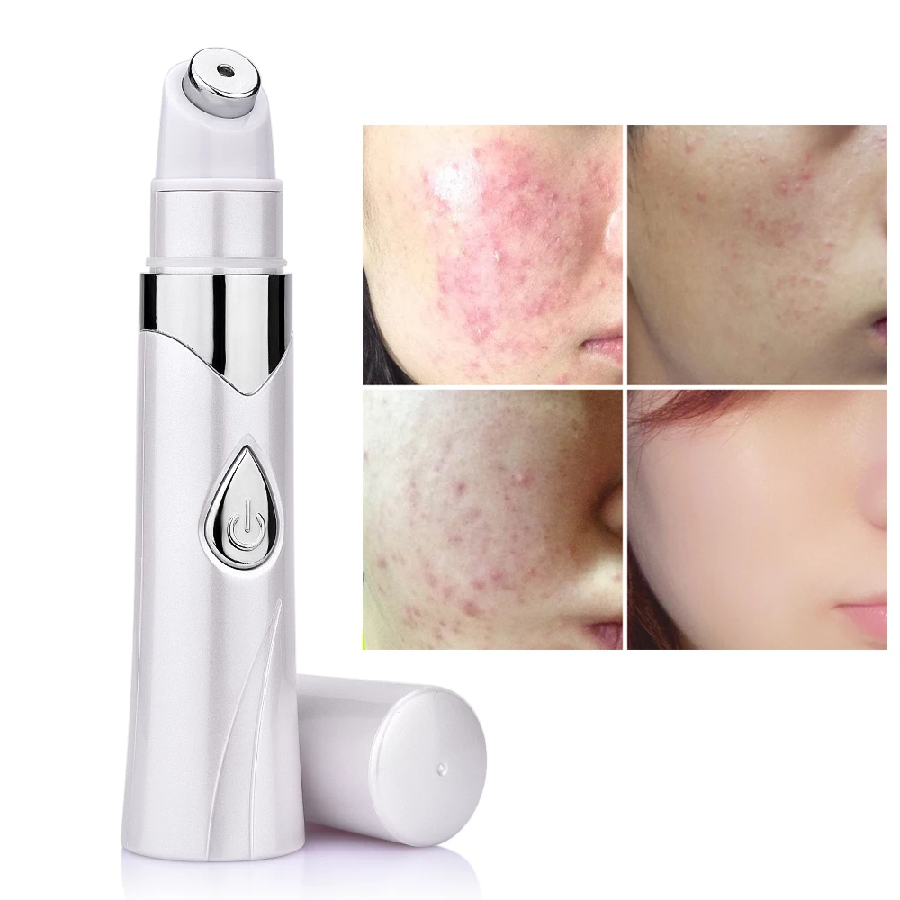 Portable Blue Light Therapy Acne Laser Pen Skin Spots Removal Pen Anti Varicose Spider Vein Eraser Treatment
