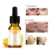 Витамин С Гиалуроновая Кислота Сыворотка Для Лица Wonder Liquid Skin Serum Essence Anti Aging Fade Dark Spot Морщины Увлажняющий Уход За Кожей