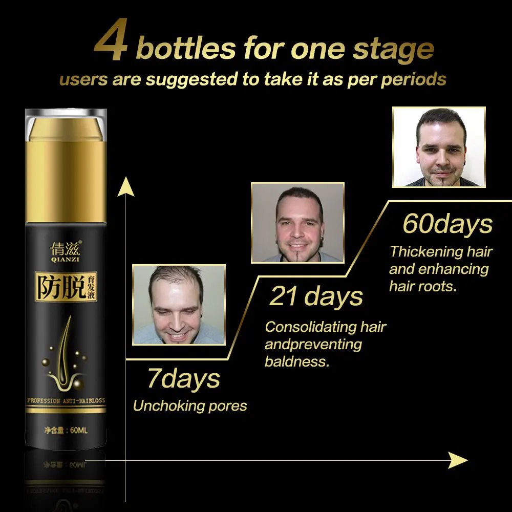 Продукты против выпадения волос для быстрого роста волос лечение мужчин t Hair Essence Oil натуральный Уход за волосами продукты для женщин мужчин волос Тоник