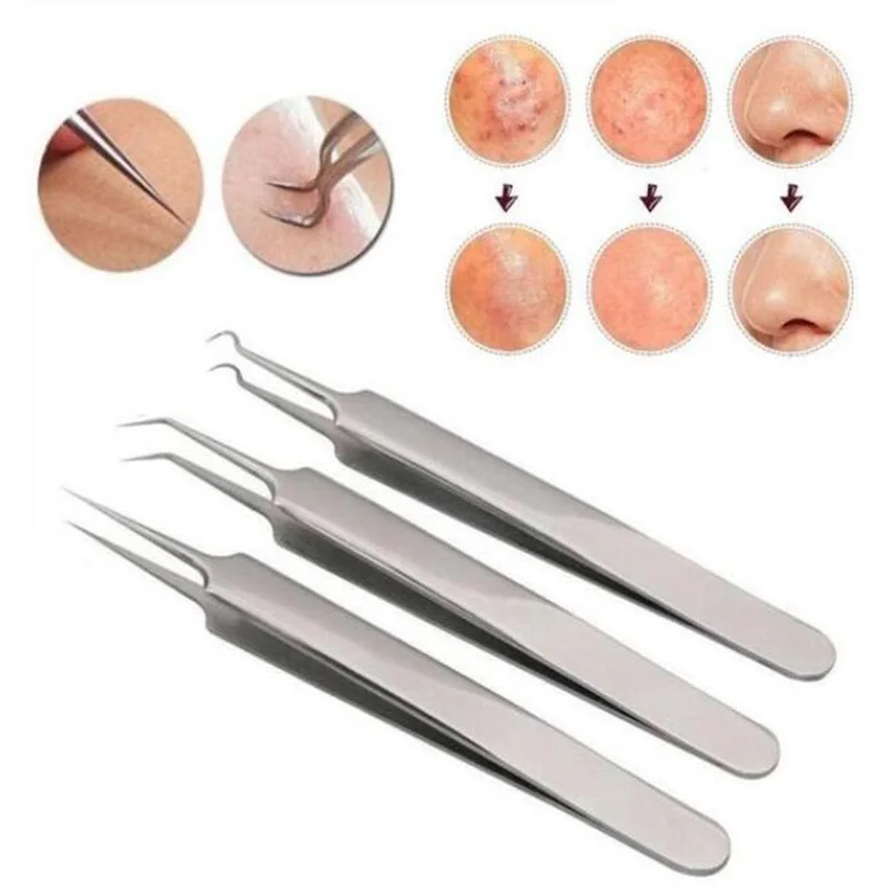

3pc/Pack Blackhead Blemish Acne Pimple Extractor Remover Tool Set Face Skin Care blackhead tweezer Stainless Steel Needle Kit