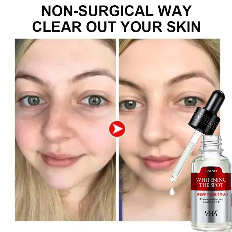 30ml Whitening Essence Brighten Skin Colour Face Care Moisturizing Anti-Aging Essence Remove Freckle Spots Serum Skin Care TSLM2
30ml Whitening Essence Brighten Skin Colour Face Care Moisturizing Anti-Aging Essence Remove Freckle Spots Serum Skin Care TSLM2