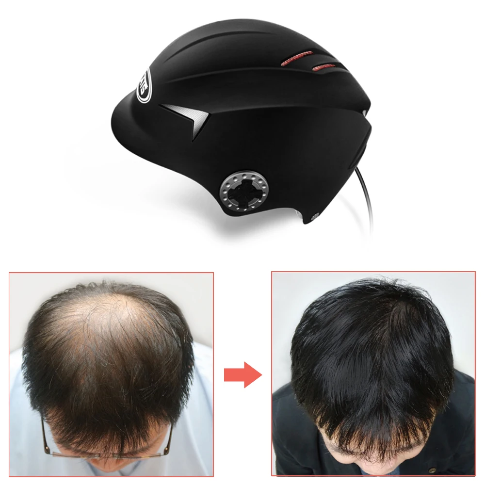 Обновленный лазерный шлем для волос, медицинская шапка для быстрого роста волос, решение для выпадения волос для мужчин и женщин, диоды для лечения мужчин, шапки для волос
