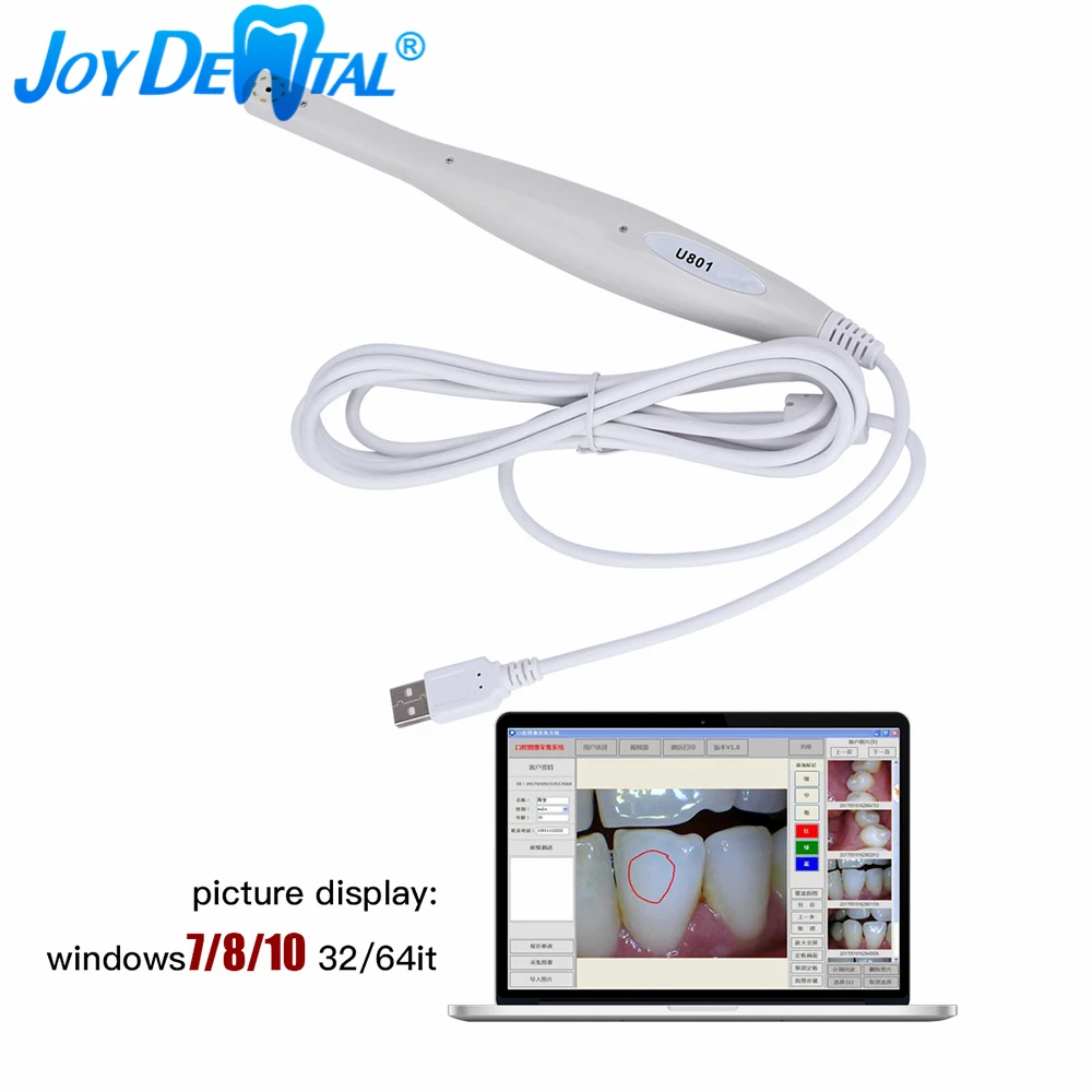 Dental Usb Intraoral Camera Digital Oral Endoscope U801 8 White Cold Light Led Automatic