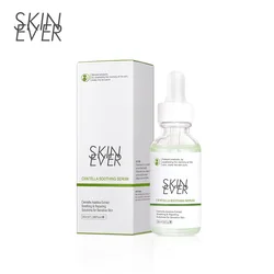 Centella Asiatica Acne Removing Essence face Serum liquid Moisturizing Anti Wrinkle Shrink Pore Control Oil Whiten Skin 30ml